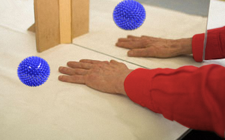 Spiegeltherapie